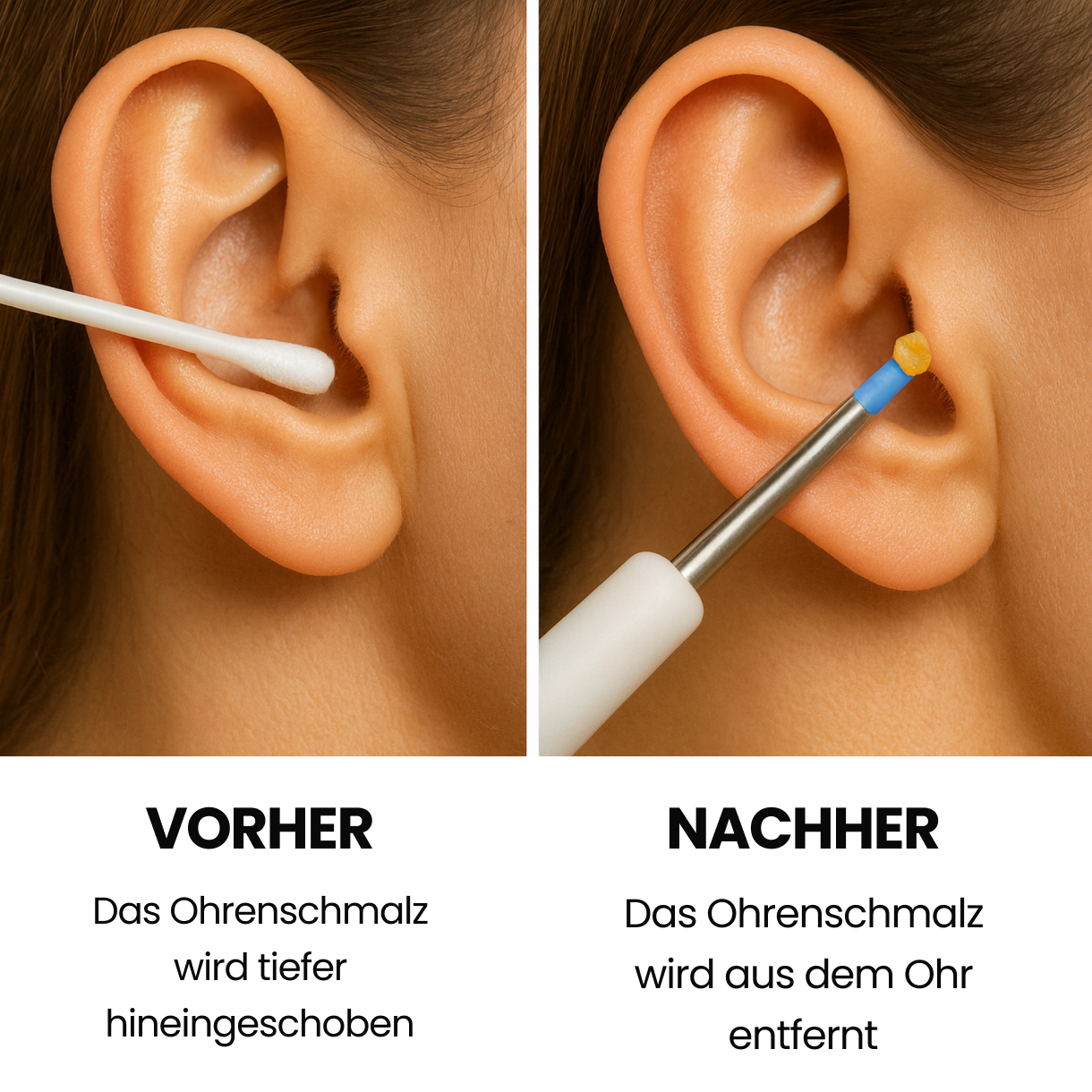 Kit AureonPro™ – Reinigungsgerät