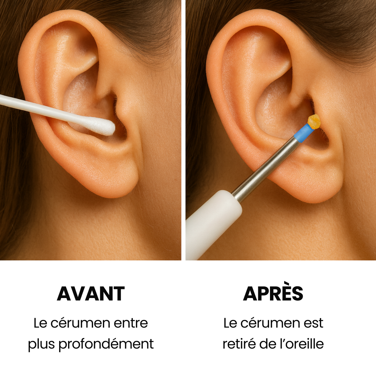 Kit AureonPro™ - Dispositif de Nettoyage