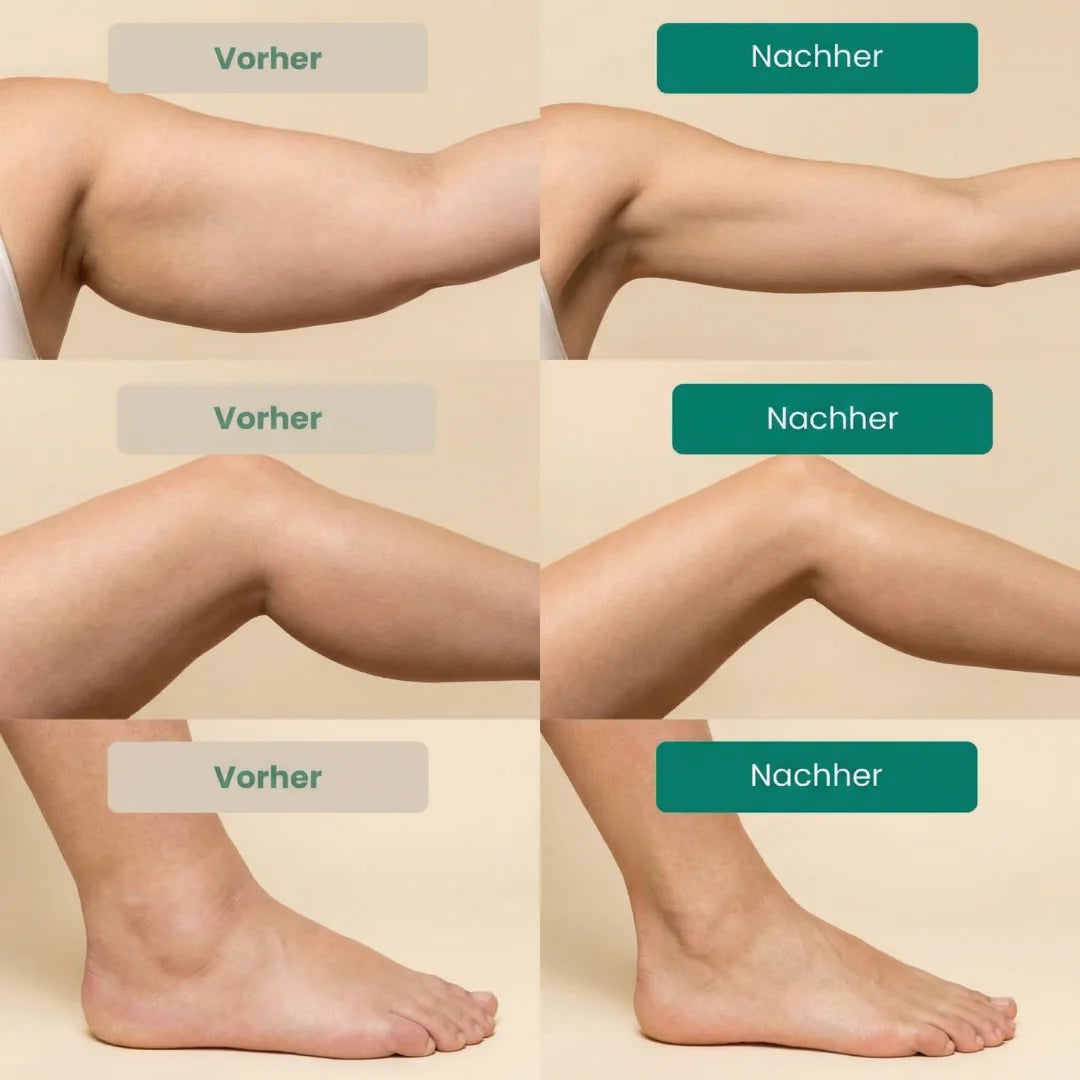 Lymphdrainage OhMySwiss™