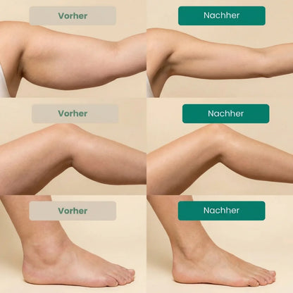 Lymphdrainage OhMySwiss™
