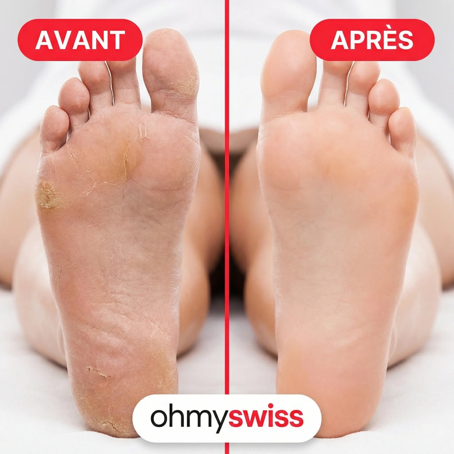 FootGlow Râpe Anti-corne OhMySwiss™