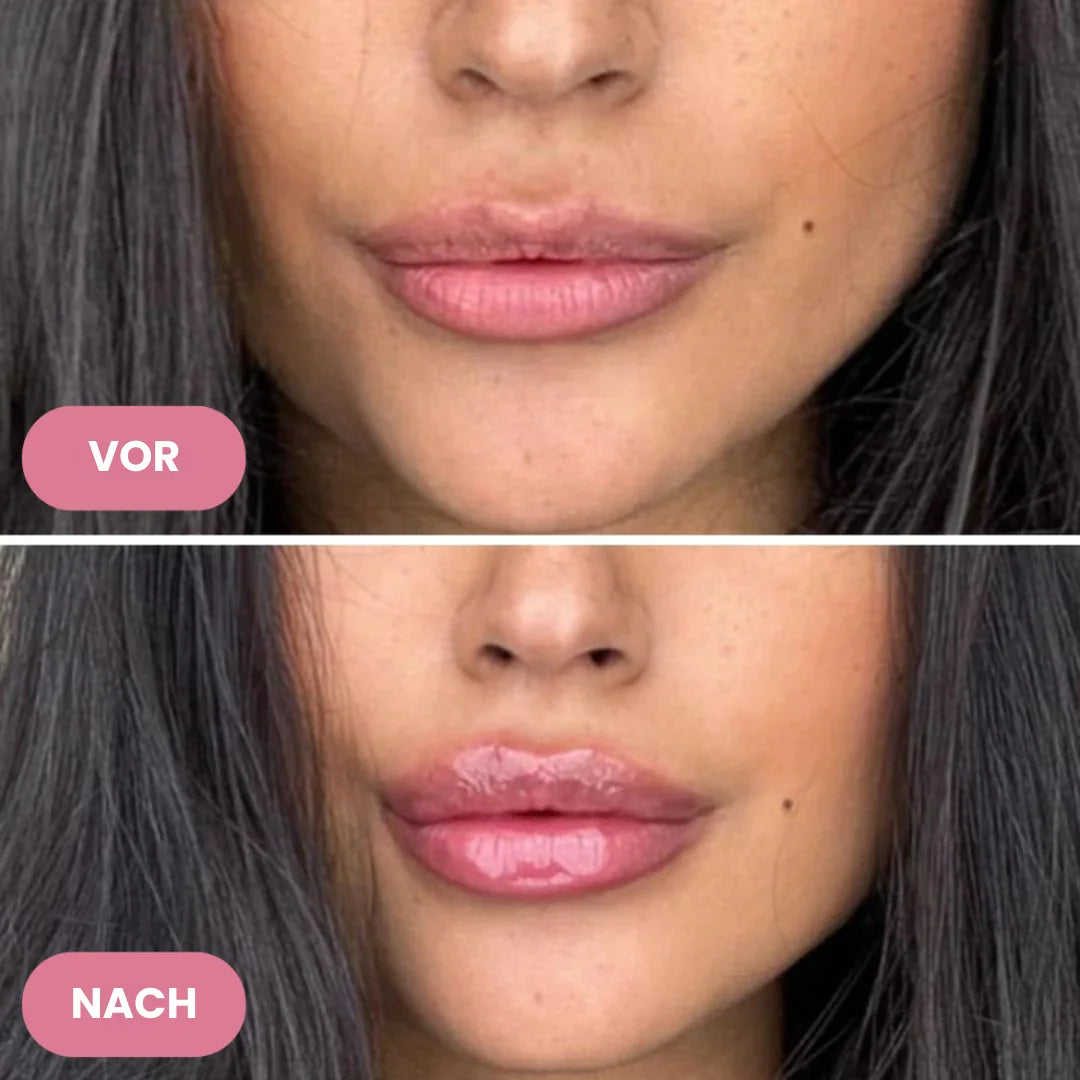 Lippen-Auffüll-Serum OhMySwiss™