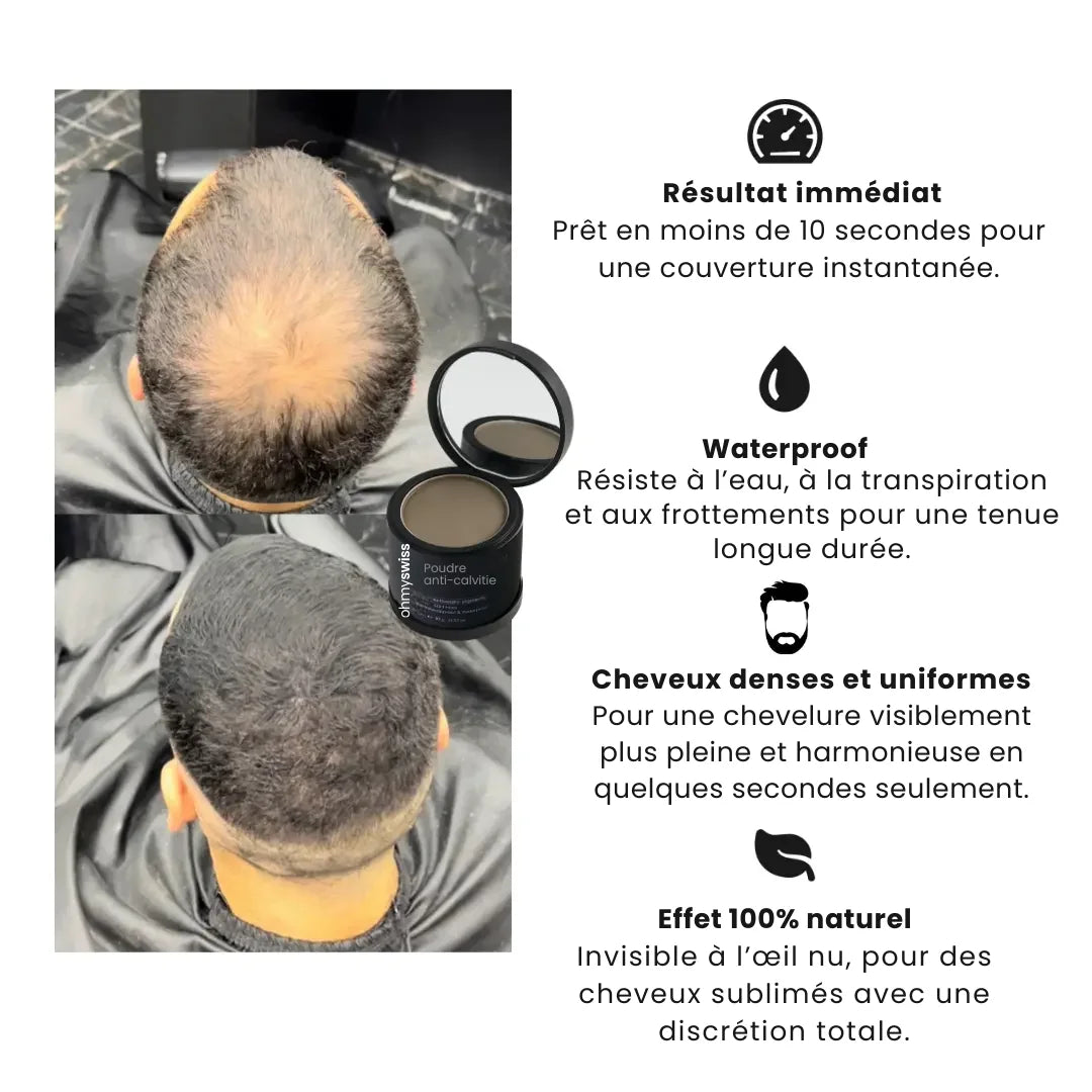 Poudre Anti-Calvitie OhMySwiss™