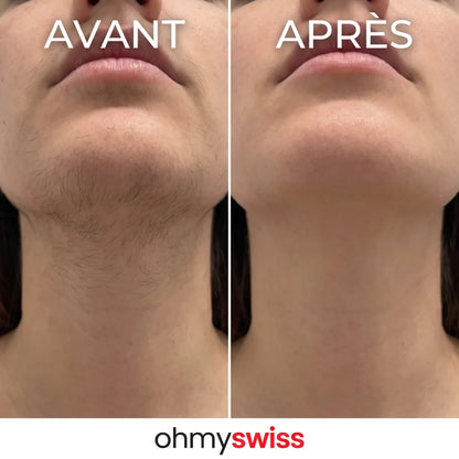 Ohmyswiss pflanzliches Serum gegen Haarwachstum