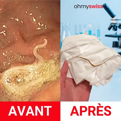 Kit détox à l’huile de ricin Ohmyswiss
