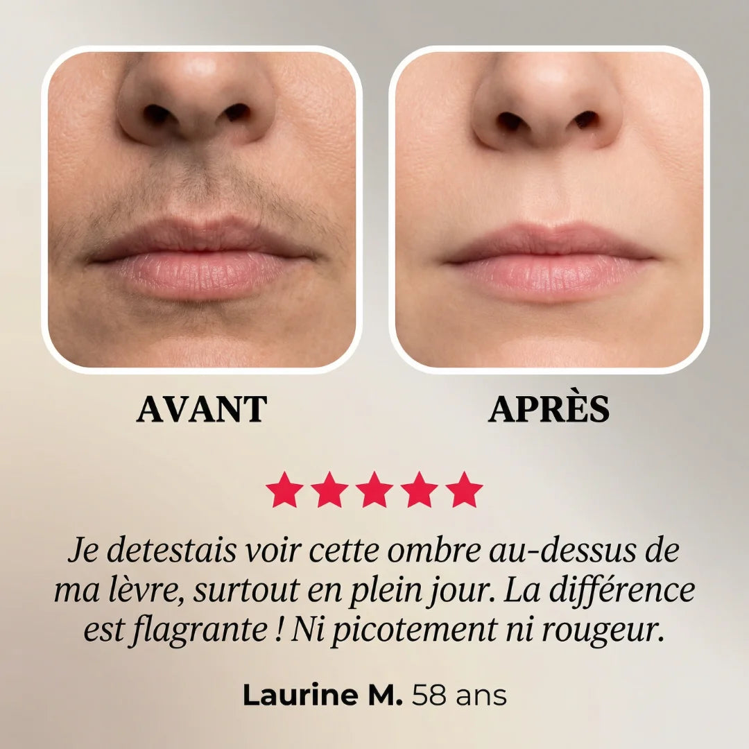 Soft Épilateur 2.0 OhMySwiss™