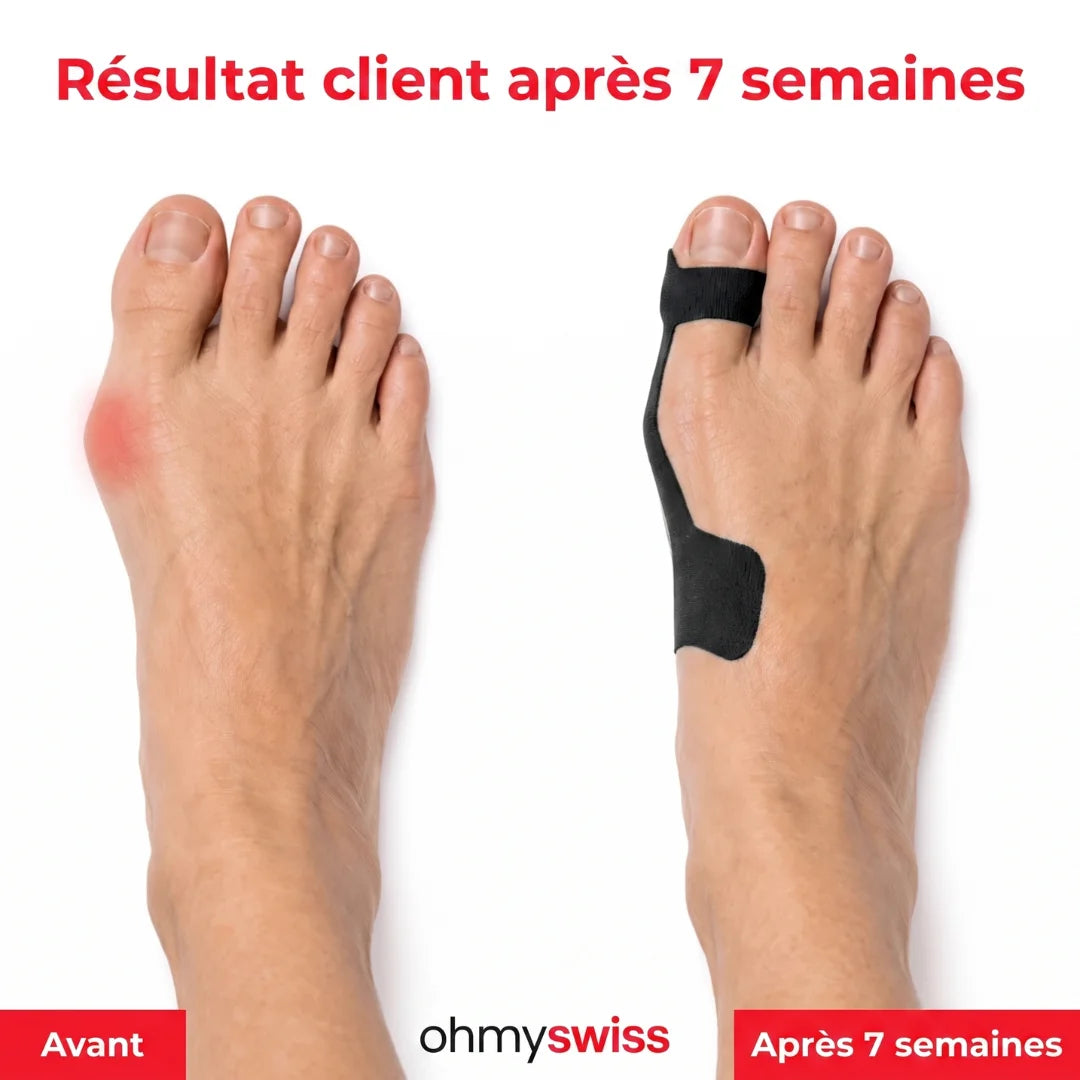 Bande pour hallux valgus Ohmyswiss