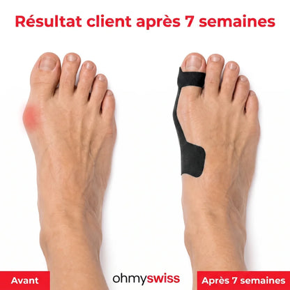 Bande pour hallux valgus Ohmyswiss