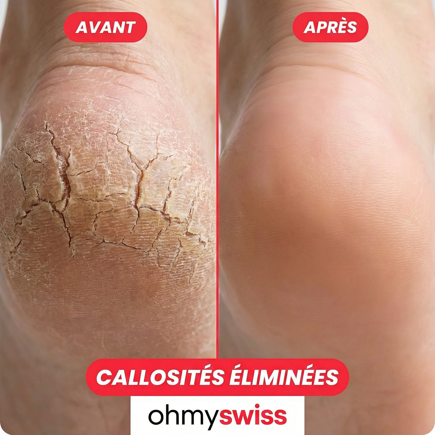 FootGlow Râpe Anti-corne OhMySwiss™