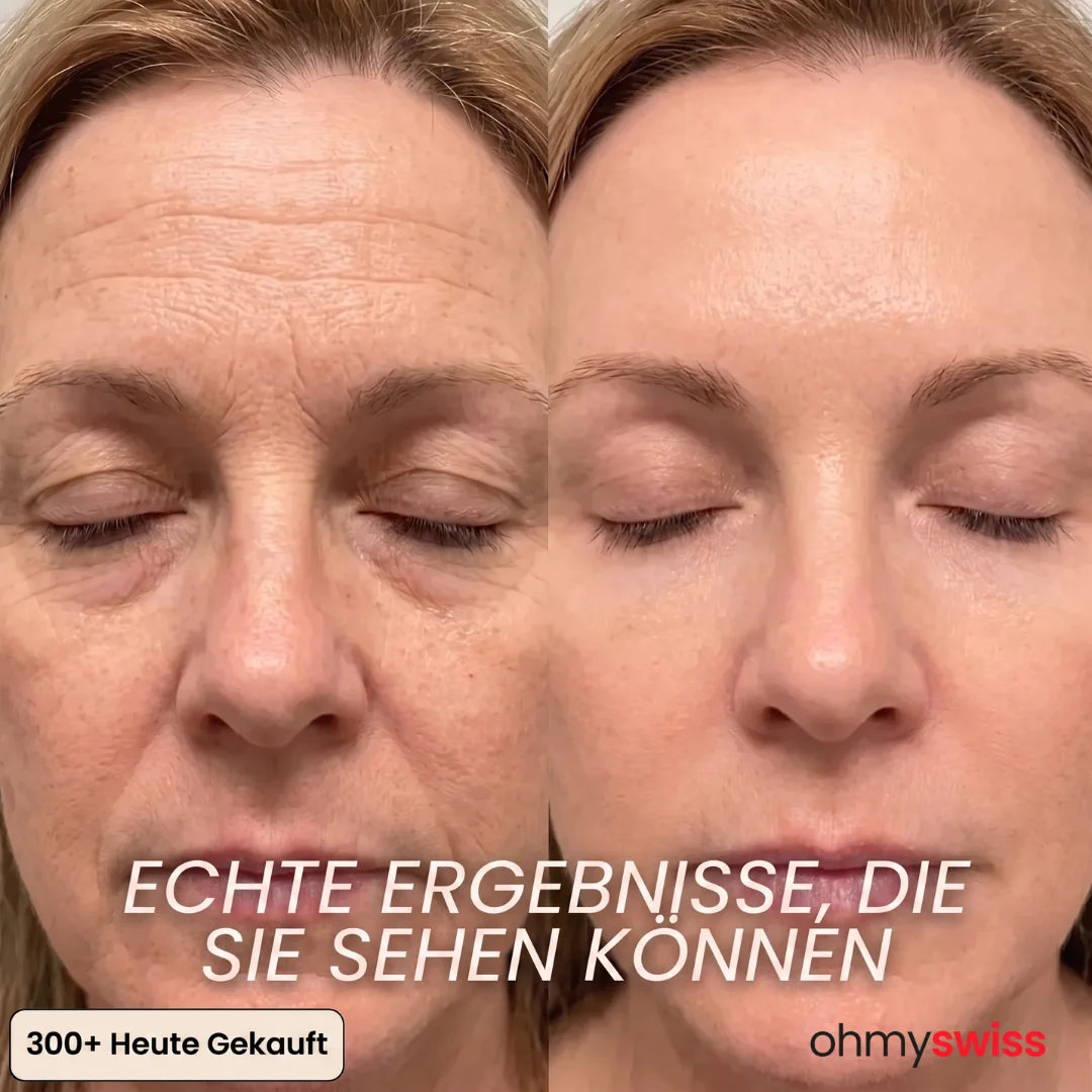 OhMySwiss Bio-Kollagen Volumen-Stick