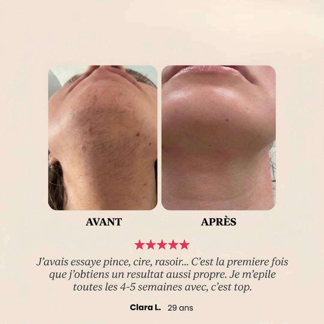 Soft Épilateur 2.0 OhMySwiss™