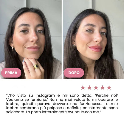 Siero Rimpolpante Labbra OhMySwiss™