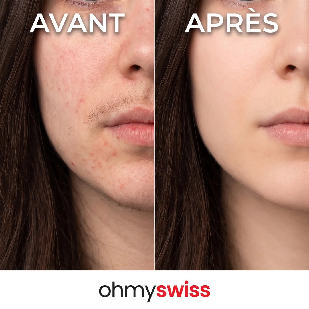 Ohmyswiss pflanzliches Serum gegen Haarwachstum