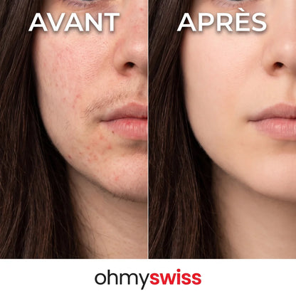 Ohmyswiss pflanzliches Serum gegen Haarwachstum