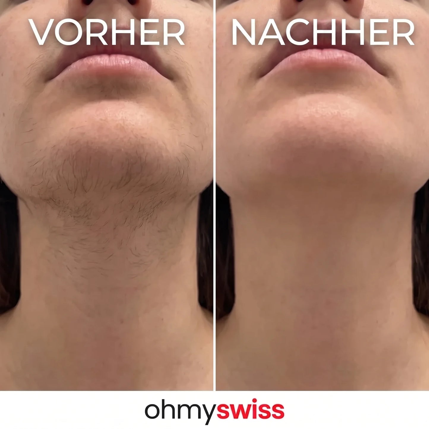 OhMySwiss Siero a base di erbe per la ricrescita dei capelli
