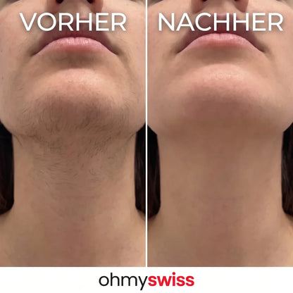 OhMySwiss Siero a base di erbe per la ricrescita dei capelli