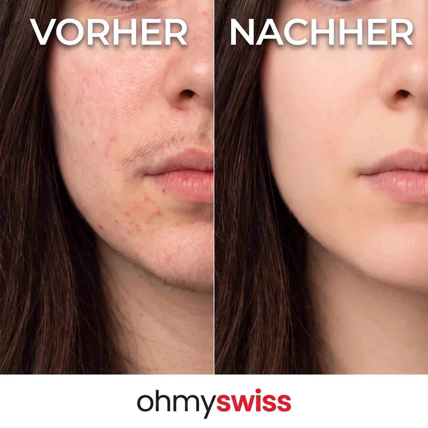 OhMySwiss Siero a base di erbe per la ricrescita dei capelli