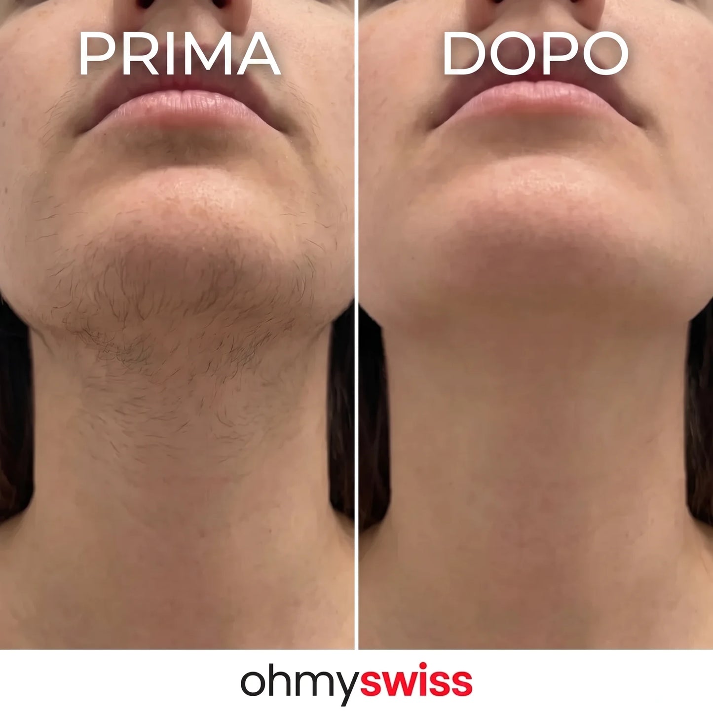 Ohmyswiss-Serum gegen das Nachwachsen von Pflanzen