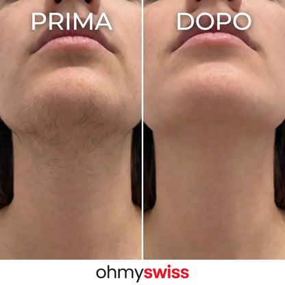 Ohmyswiss-Serum gegen das Nachwachsen von Pflanzen