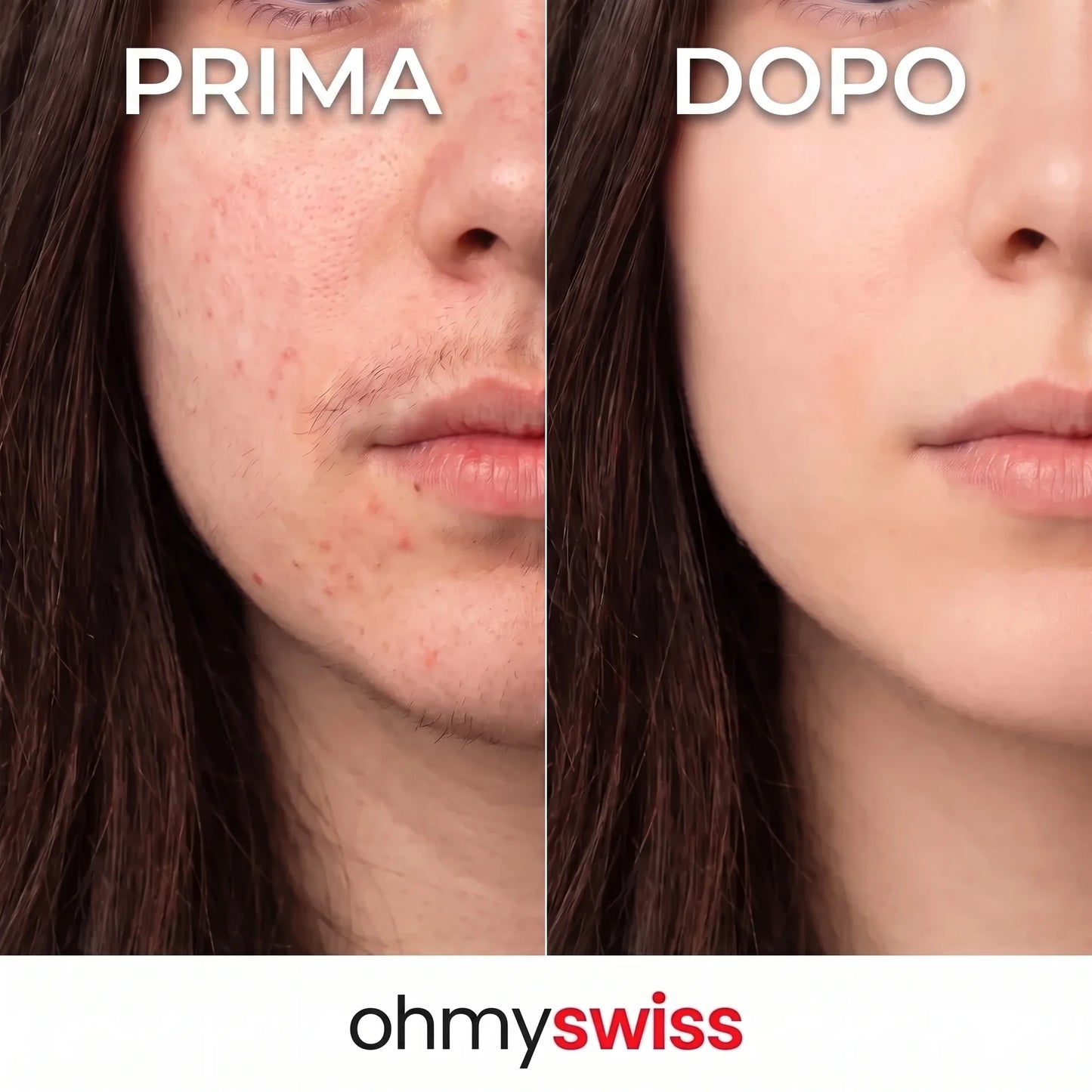 Ohmyswiss-Serum gegen das Nachwachsen von Pflanzen