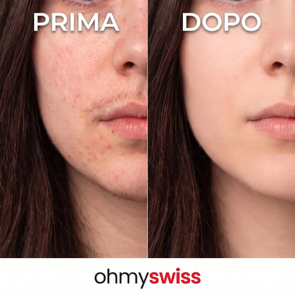 Ohmyswiss-Serum gegen das Nachwachsen von Pflanzen