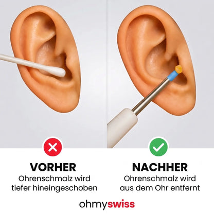AureonPro™ Kit - Reinigungsgerät