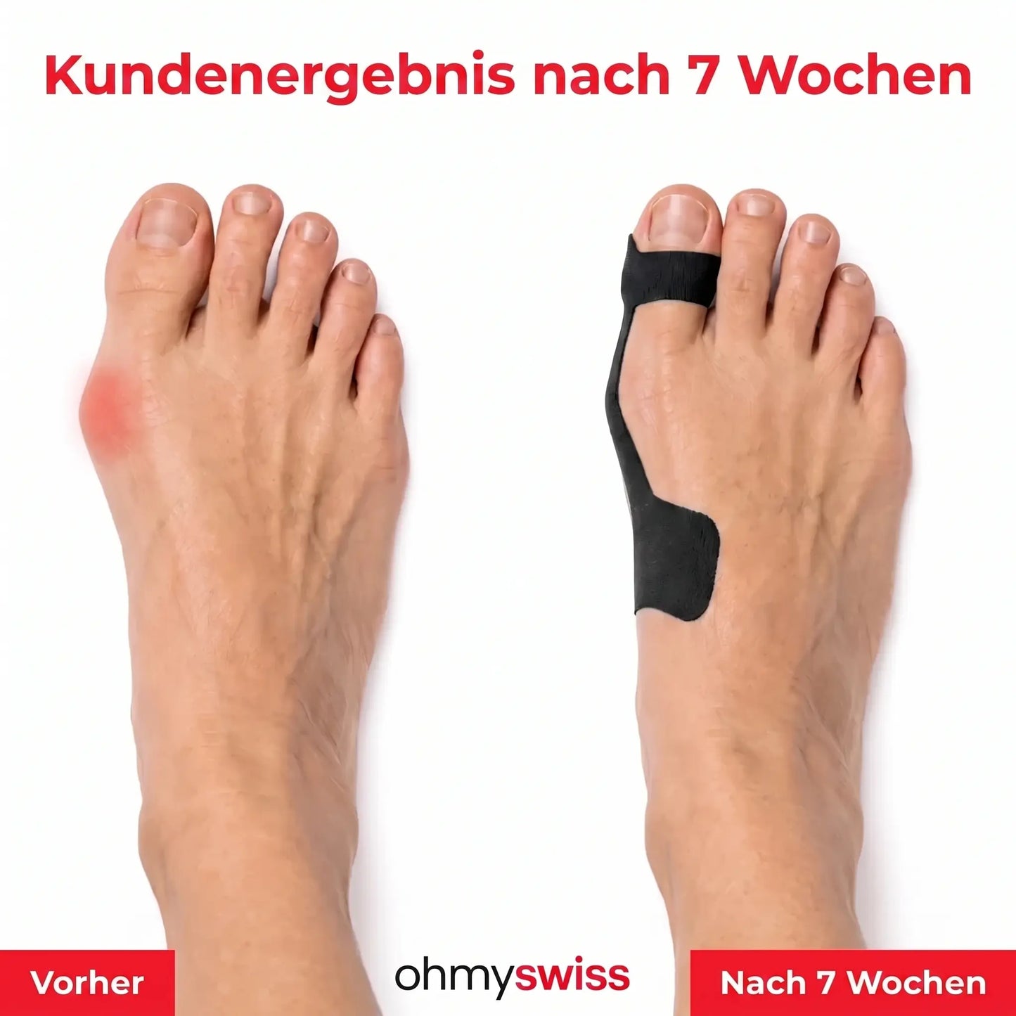 Ohmyswiss-Hallux-valgus-Bandage