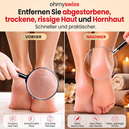 Ohmyswiss Elektrisches Pediküregerät