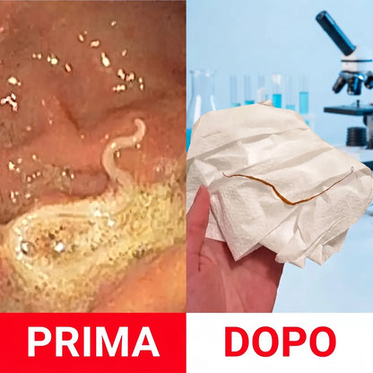 Kit detox con olio di ricino