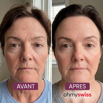 Bio-Kollagen-Maske + Pinsel von Ohmyswiss