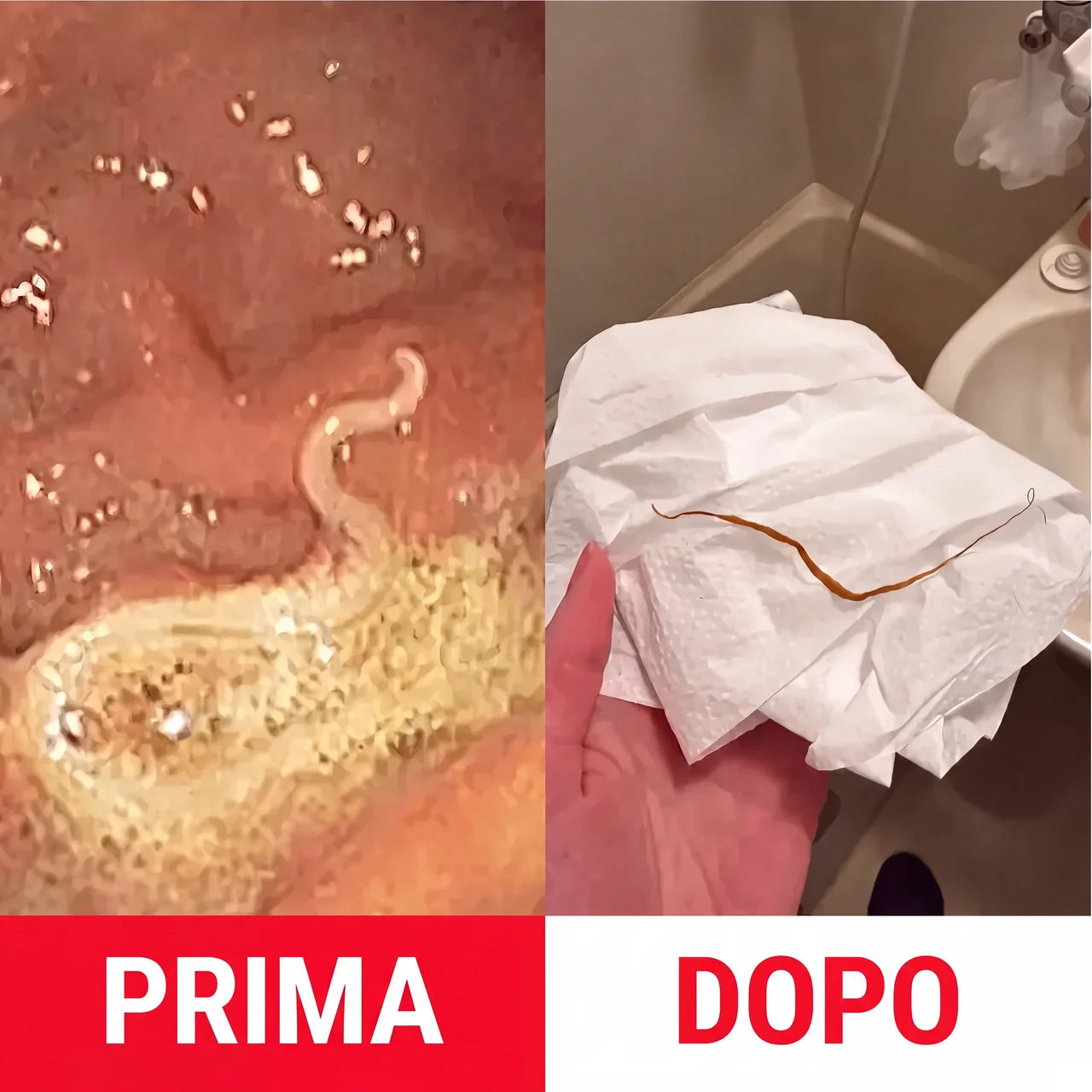 Kit detox con olio di ricino