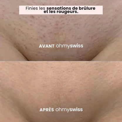 Rasoir Anti-irritations OhMySwiss™