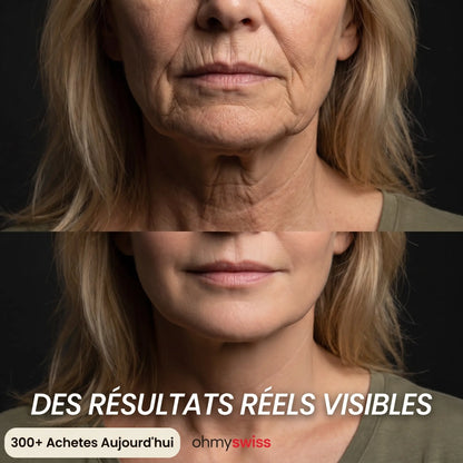 Stick repulpant bio-collagène Ohmyswiss