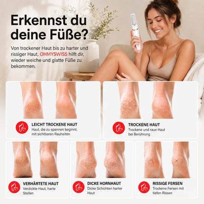 Silk Pro – Elektrische Hornhautfeile von OHMYSWISS