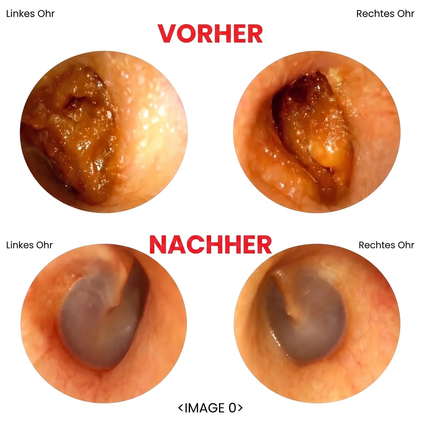 Intelligenter HD Ohrenreiniger OHMYSWISS